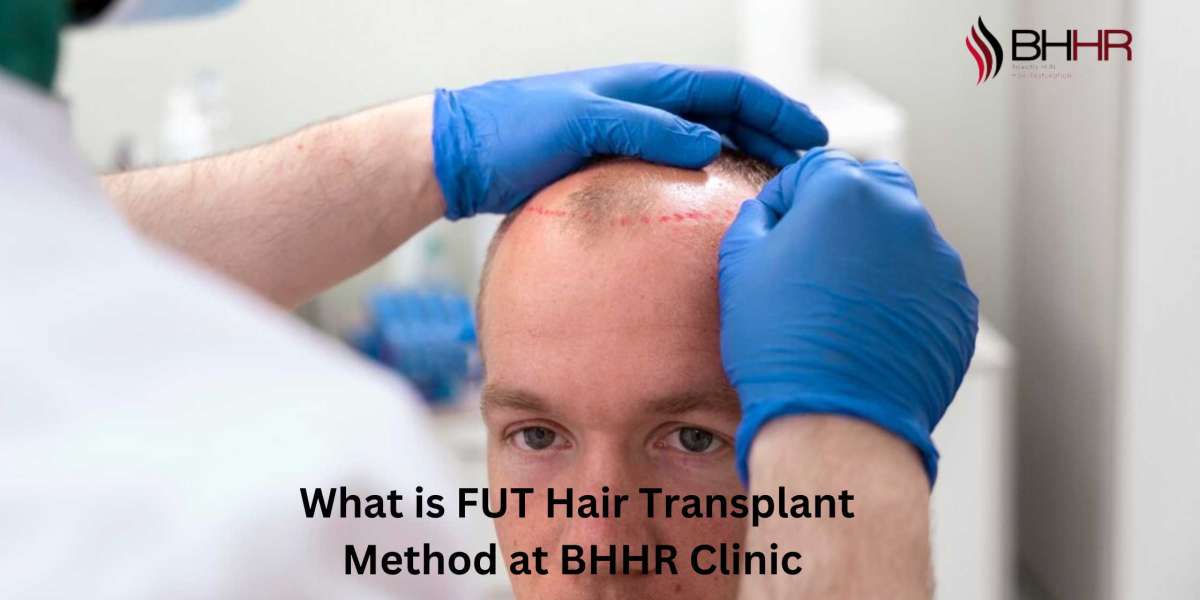 What is FUT Hair Transplant Method at BHHR Clinic