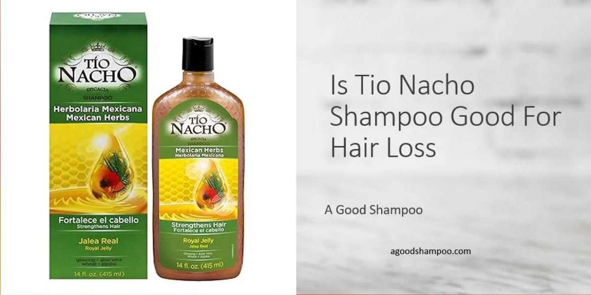 Tio Nacho Shampoo: Is It Good for Hair Loss?