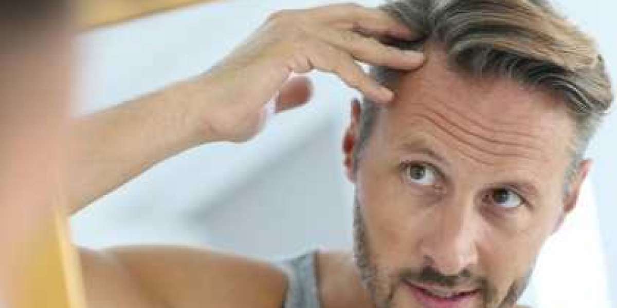 There are six key factors for a successful hair transplant