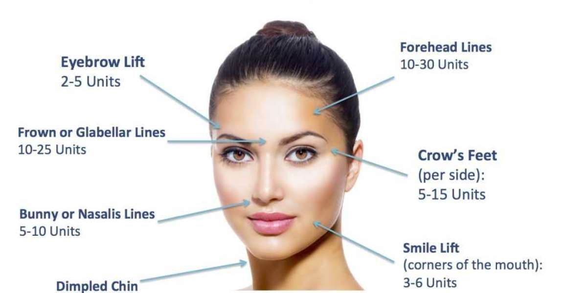 How Many Units of Botox for Forehead: Understanding the Dosage for Optimal Results