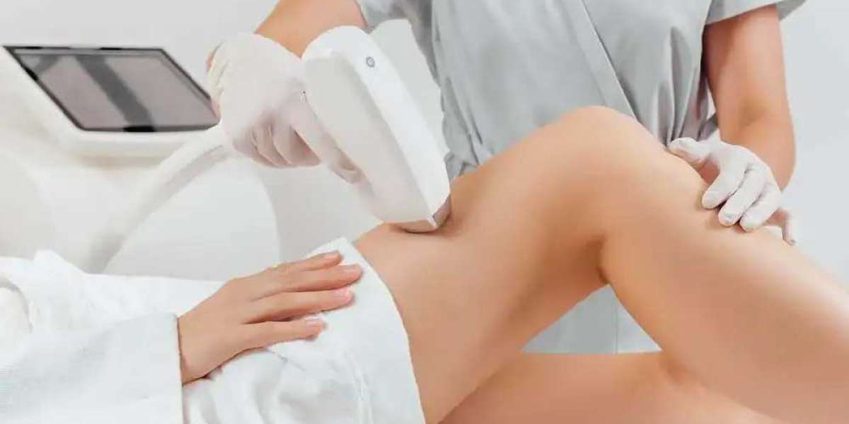 Best Laser Hair Removal in Dallas, TX : Sleek Laser Solutions