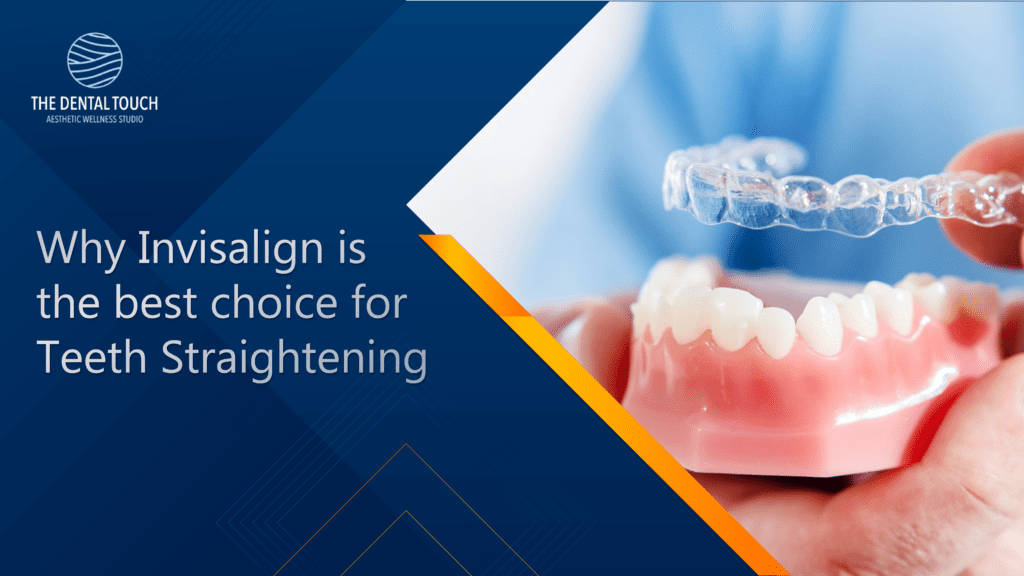 Straighten your teeth with Invisalign | My Wellness Studio