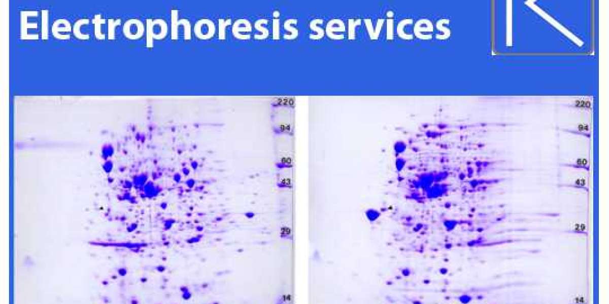 How Does Gel Electrophoresis Differ from SDS-PAGE?