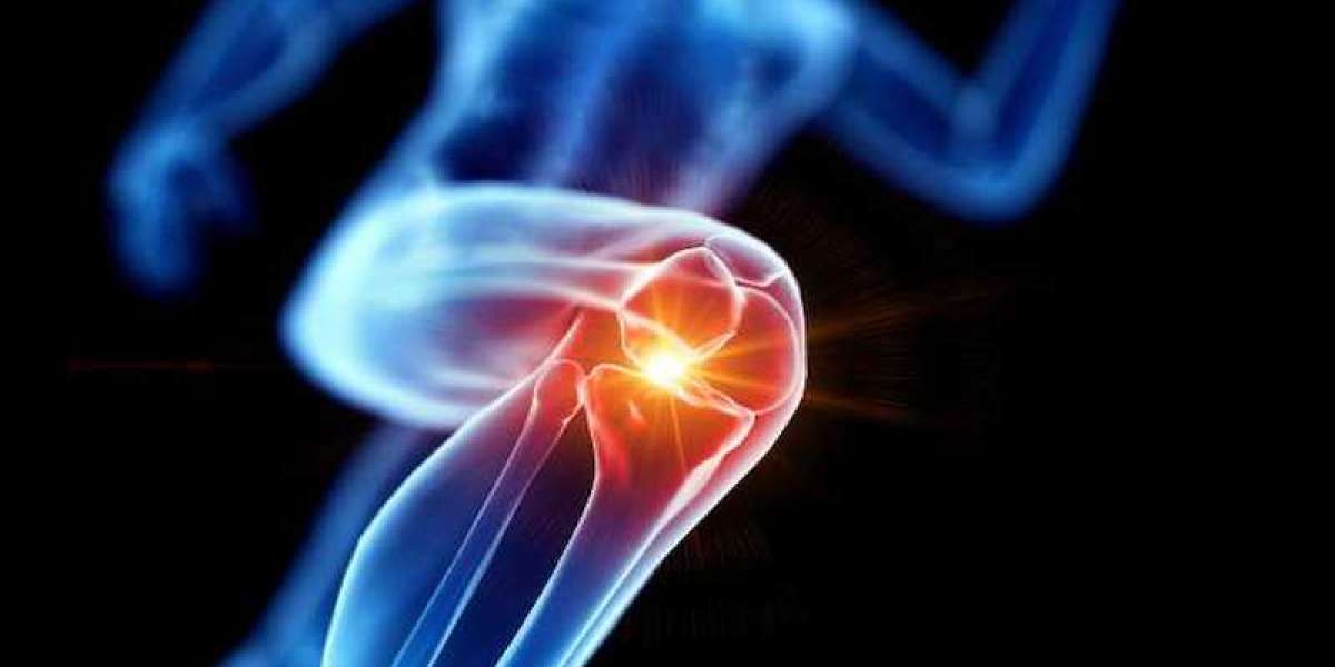 Best Exercises for Strengthening Knees and Preventing Pain